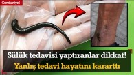 Sülük tedavisi yaptıranlar dikkat! Yanlış tedavi hayatını kararttı