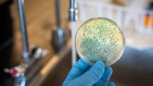 Japonya’da ‘et yiyen’ STSS bakterisi vaka sayısı en yüksek seviyesinde