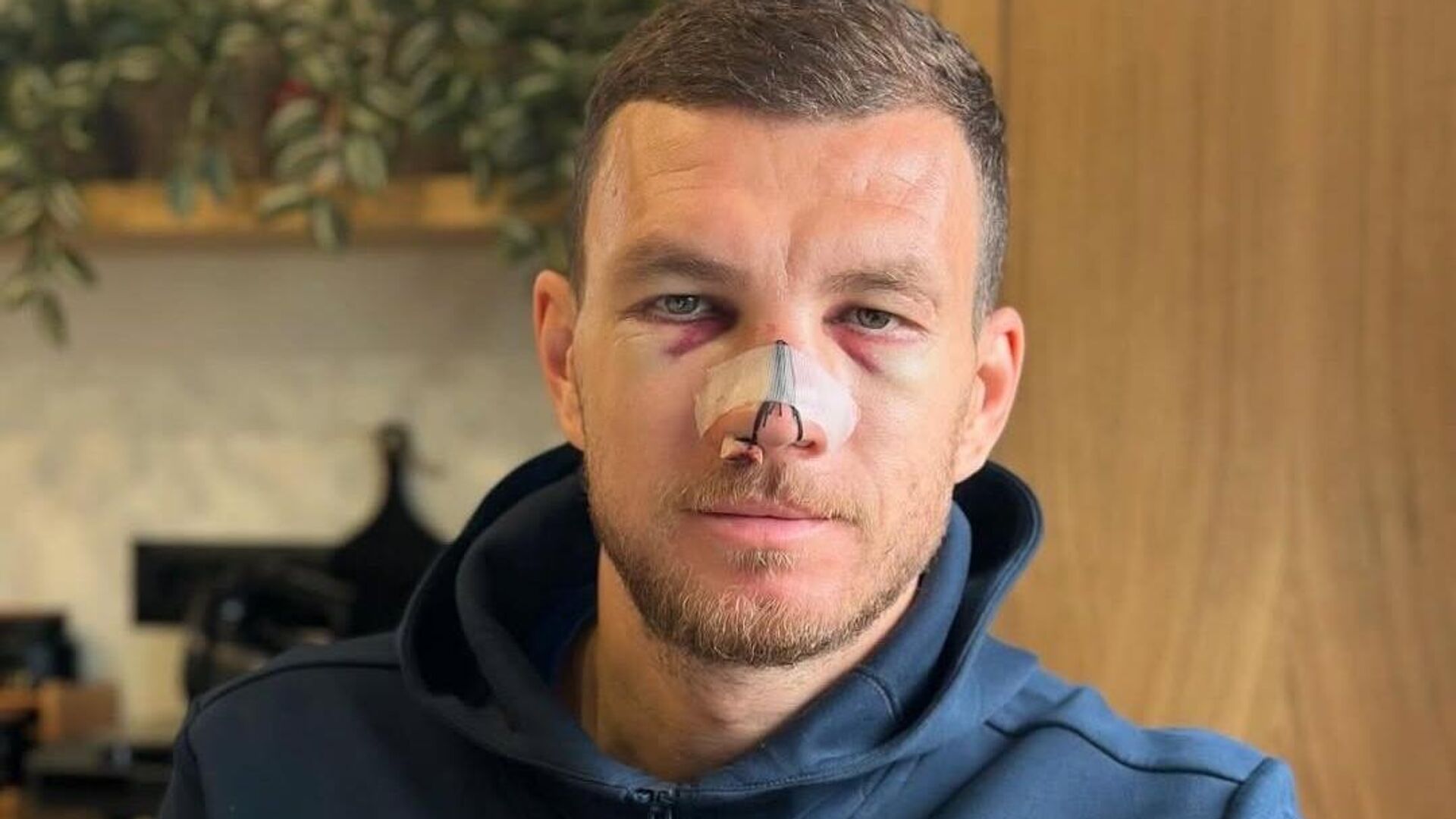 Fenerbahçeli Edin Dzeko’dan kötü haber geldi: Sakatlığı nedeniyle kadrodan çıkarıldı