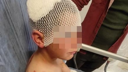Isparta’ta başıboş sokak köpeği saldırısı: 9 yaşındaki çocuk ölümden döndü