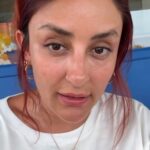 melek-mosso-makyajsiz-fotografina-gelen-yorumlara-isyan-etti-1-DOUW5X4F.jpg