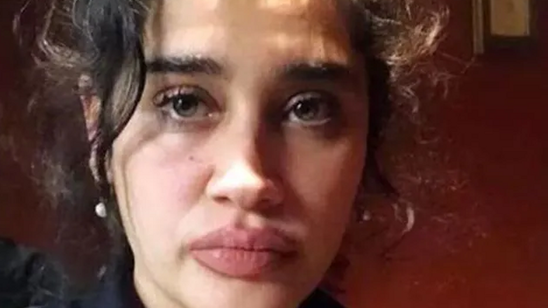 Eski oyuncu Meltem Miraloğlu, ABD’de saldırıya uğradı