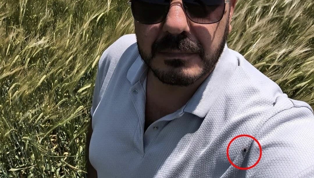 Hayat kurtaran selfie: Çektiği fotoğrafta keneyi fark etti