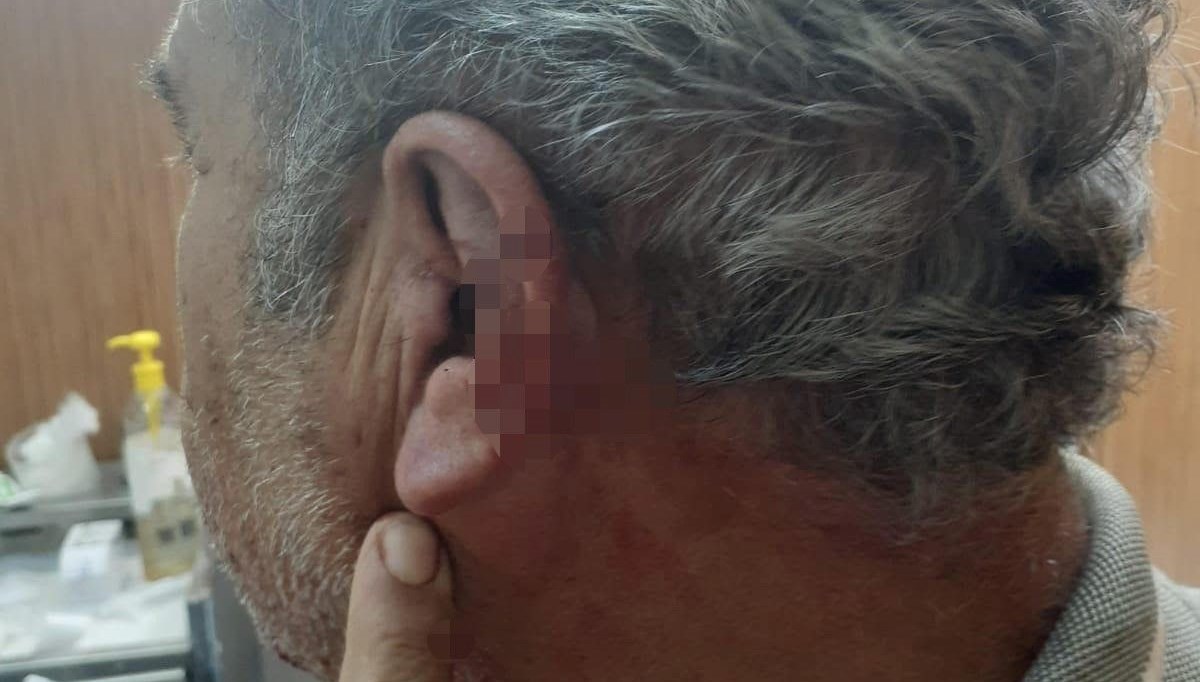 Aile hekimi ile emekli öğretmenin mesai kavgası karakolda bitti