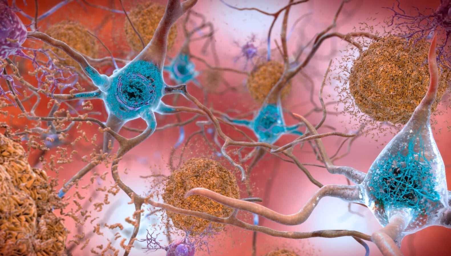Araştırmacılardan Alzheimer’a karşı yeni yöntem: SHIELD nedir?