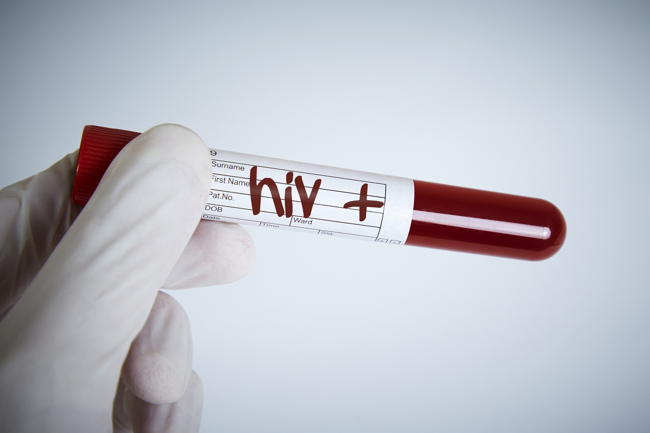 Eşinden HIV pozitif olduğunu saklayan adama hapis cezası