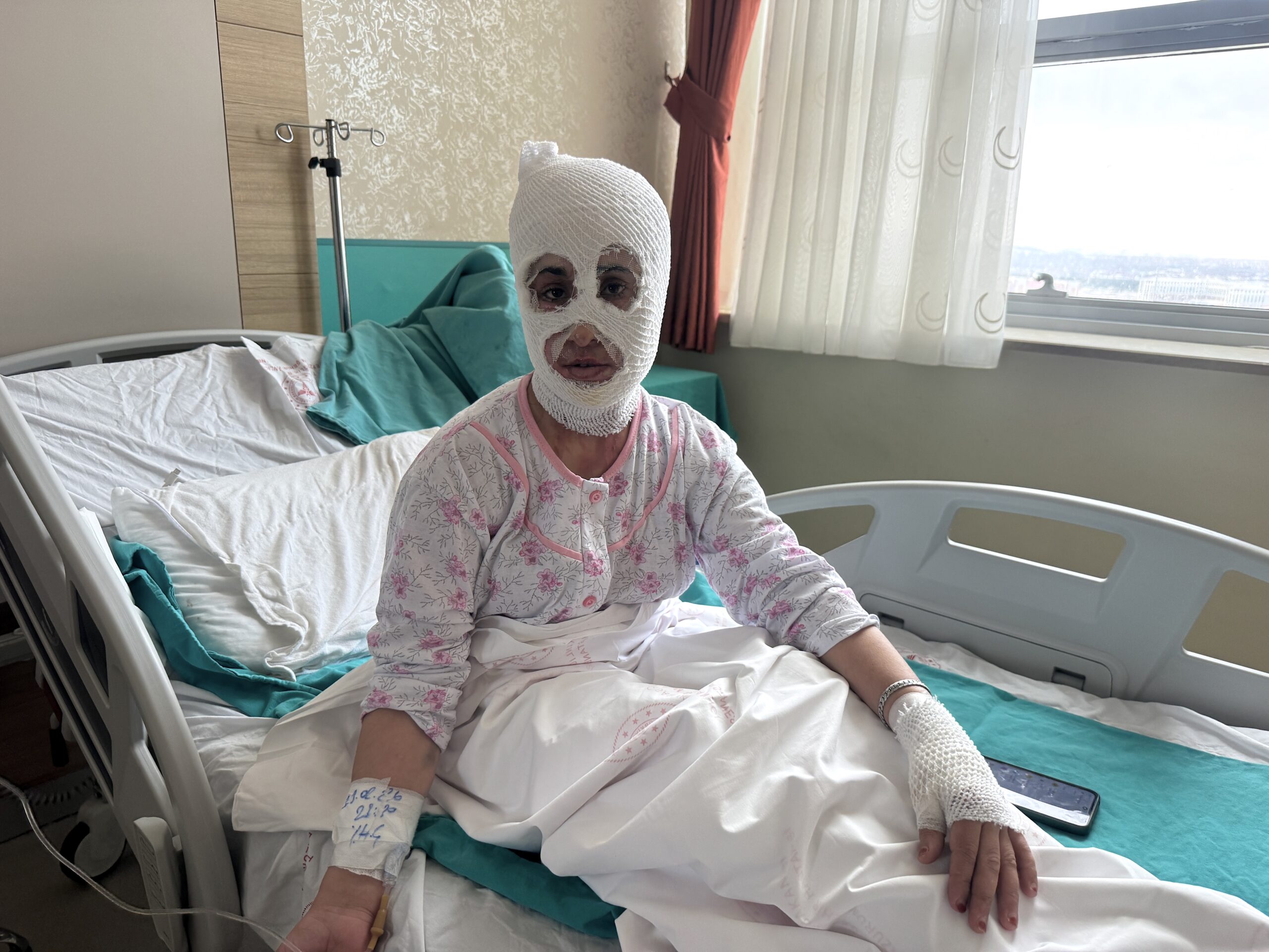 İftar hazırlığında düdüklü patladı, iki çocuk annesi hastanelik oldu