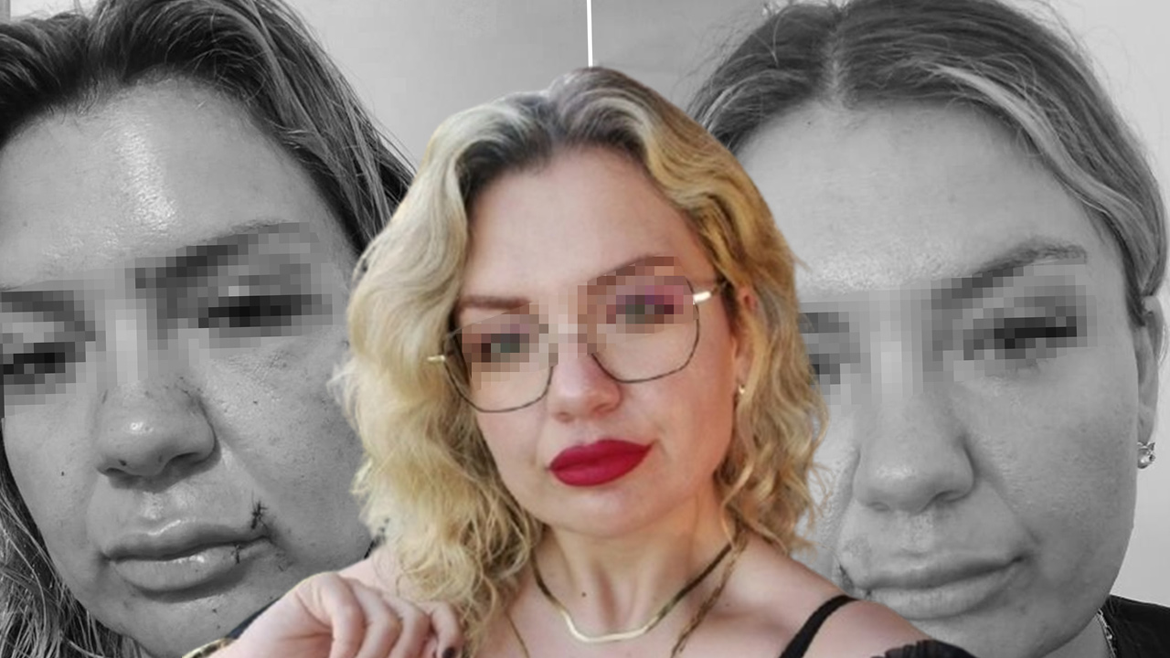 “Bugün büyük gün” diyerek aradı dehşeti yaşattı: Bıçak sırtında kırıldı