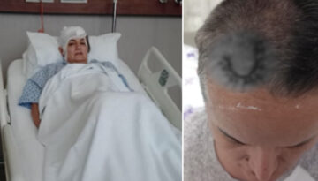 Diş ağrısı için gitti hayatı karardı. Şimdi beyninde ömür boyu cihazla yaşayacak