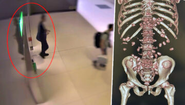 İstanbul Havalimanı’nda yürümekte zorlanan yolcu polisi alarma geçirdi. Gerçek hastanede ortaya çıktı