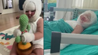 Domates konservesi bomba gibi patladı, 9 aylık bebeğin vücudu yandı