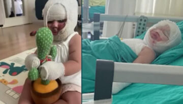 Domates konservesi bomba gibi patladı, 9 aylık bebeğin vücudu yandı