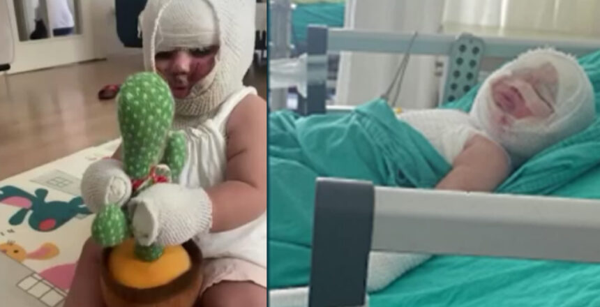 Domates konservesi bomba gibi patladı, 9 aylık bebeğin vücudu yandı