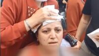 Pazarcı dehşet saçtı: Kadının başına 10 dikiş atıldı