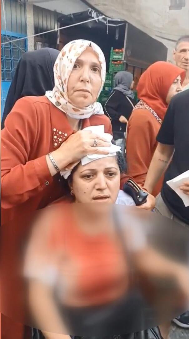 Pazarcı dehşet saçtı: Kadının başına 10 dikiş atıldı