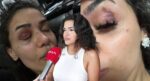 Ebru hemşirenin yardım çığlığı: “Ölmeden önce sesimi duyun”