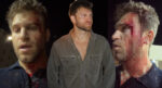 Pretty Little Liars yıldızı Keegan Allen saldırıya uğradı. Kanlar içinde olayı anlattı